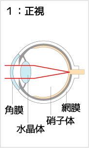 正視